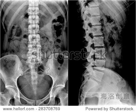 人体脊柱和骨盆的x射线:显示两种不同的观点