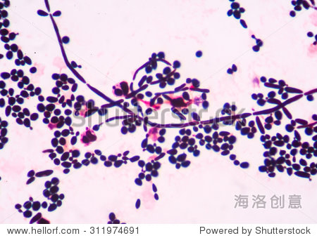 branching budding yeast cells with pseudohyphae in
