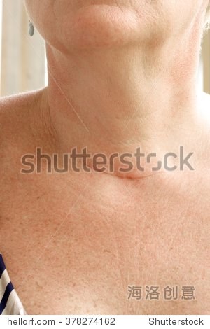 378274162.jpg