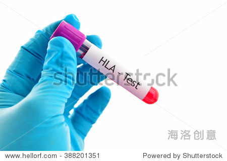 试管对HLA(人类白细胞抗原)血液样本测试 - 医