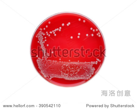 培养基上的菌落怎么辨别,红色的是细菌吗,第二