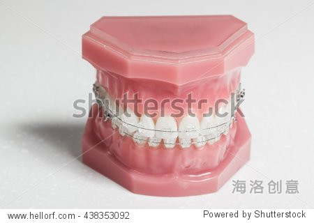 clear braces - invisible brackets for teeth straightening