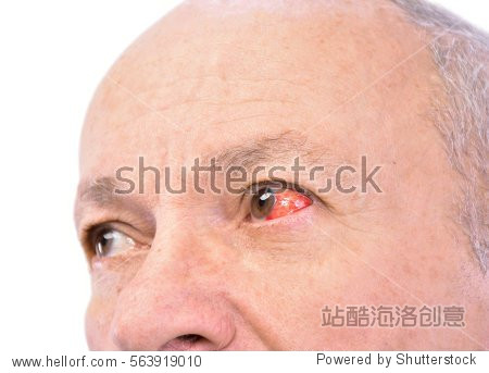 手上无缘无故的血管红了,而且那根筋也痛,怎么