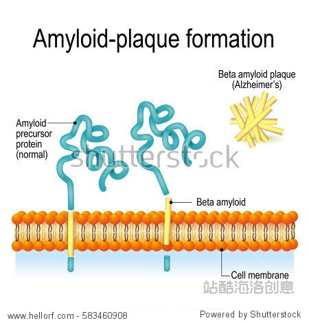 cell membrane,cell nucleus cell membrane with amyloid precursor protein (app