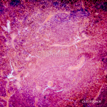 胰腺组织的显微照片 在空肠组织典型的胰腺组织
