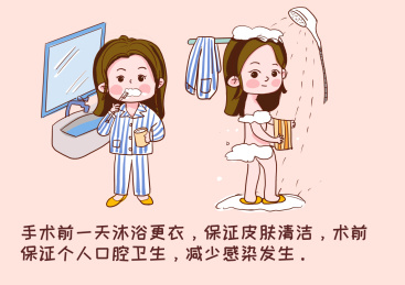 术前宣教 科普 医疗