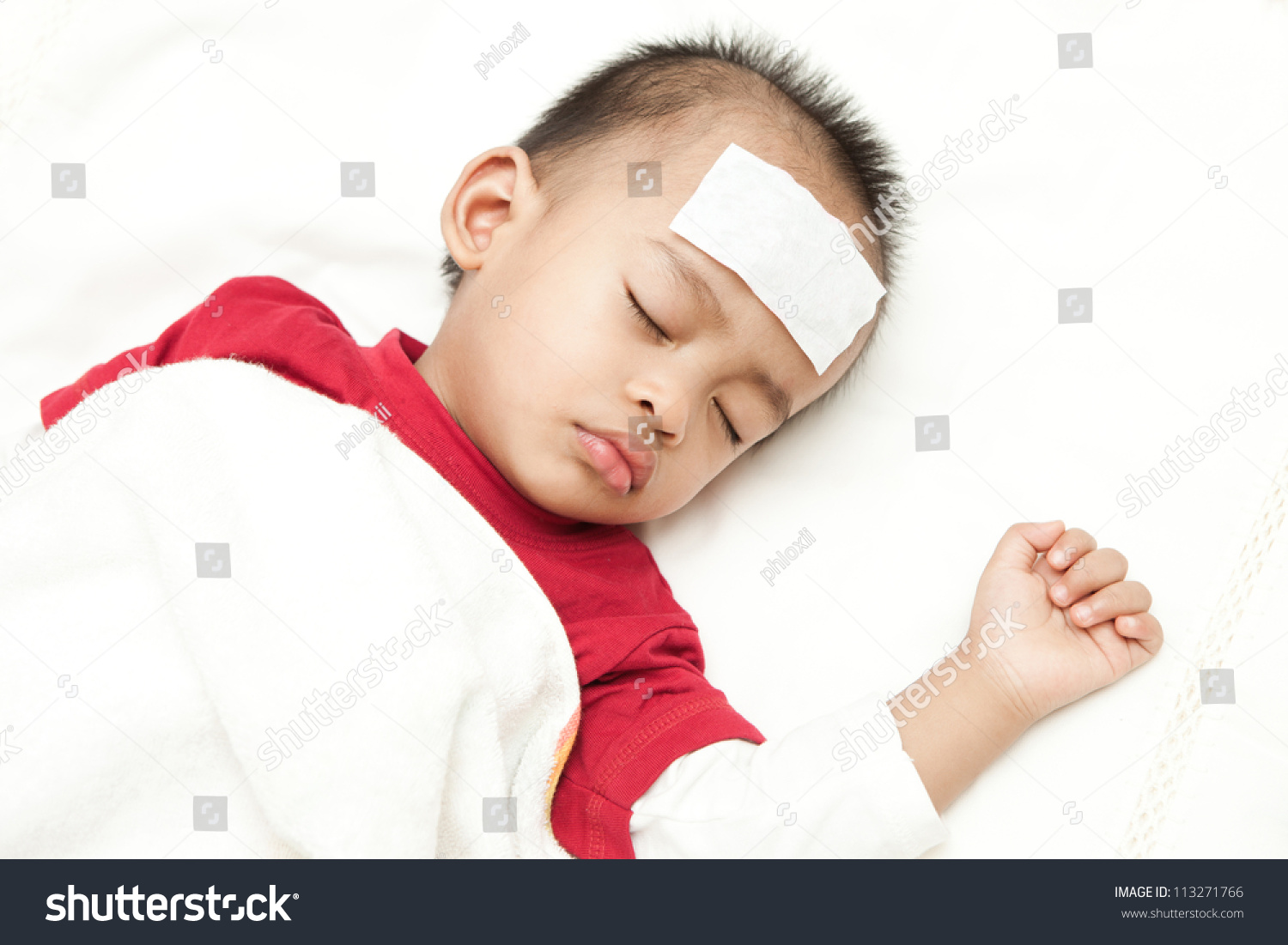Asian baby sleeping and suffering fever heat