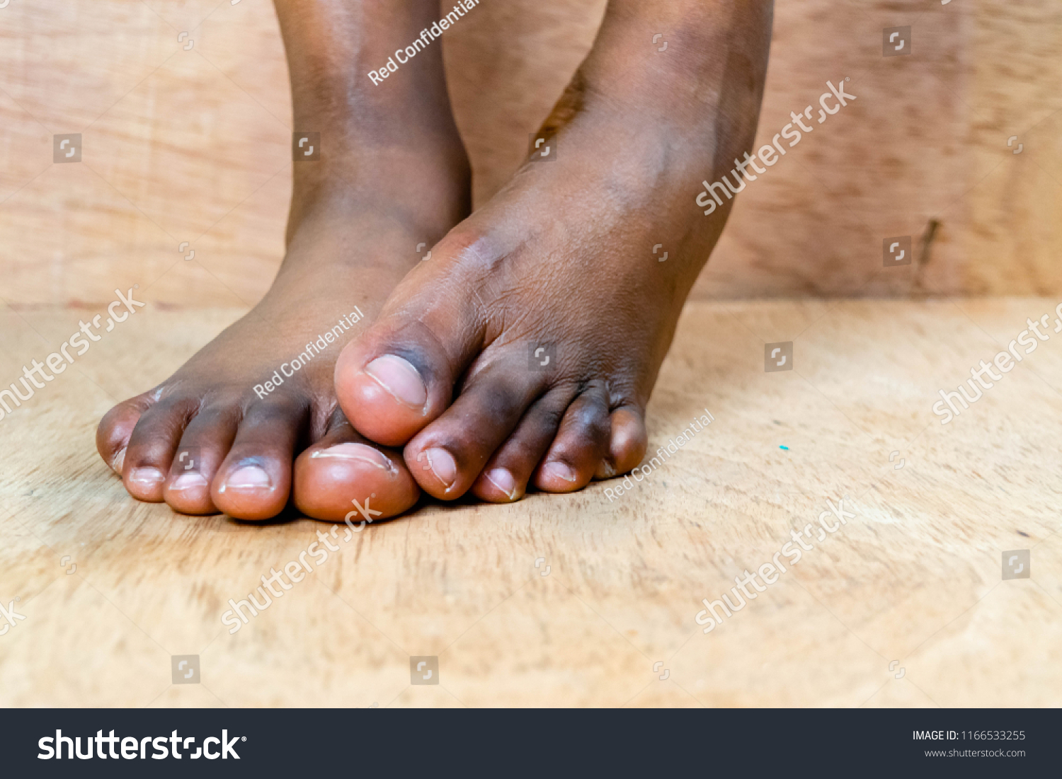 Closeup of black African woman bare foot suffering from painful toes. Removed her  stilettos in discomfort at work  shoe store or home for High heels shoe feet pain and foot problem concept