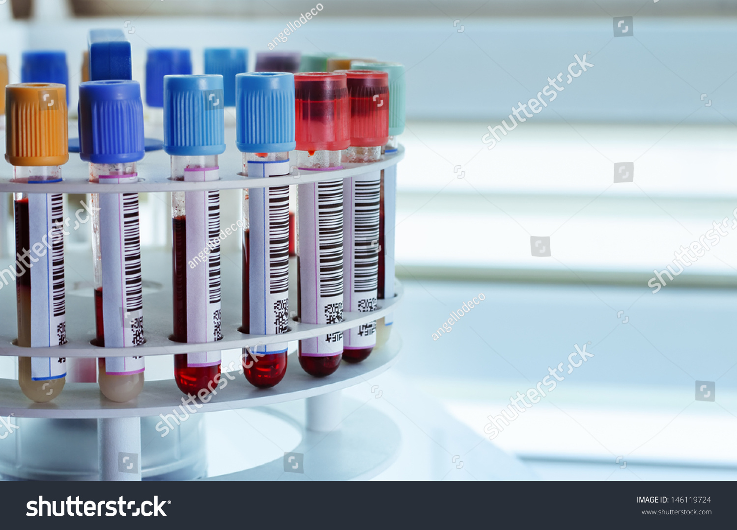 tubes prepared in lab centrifuge machine blood bank