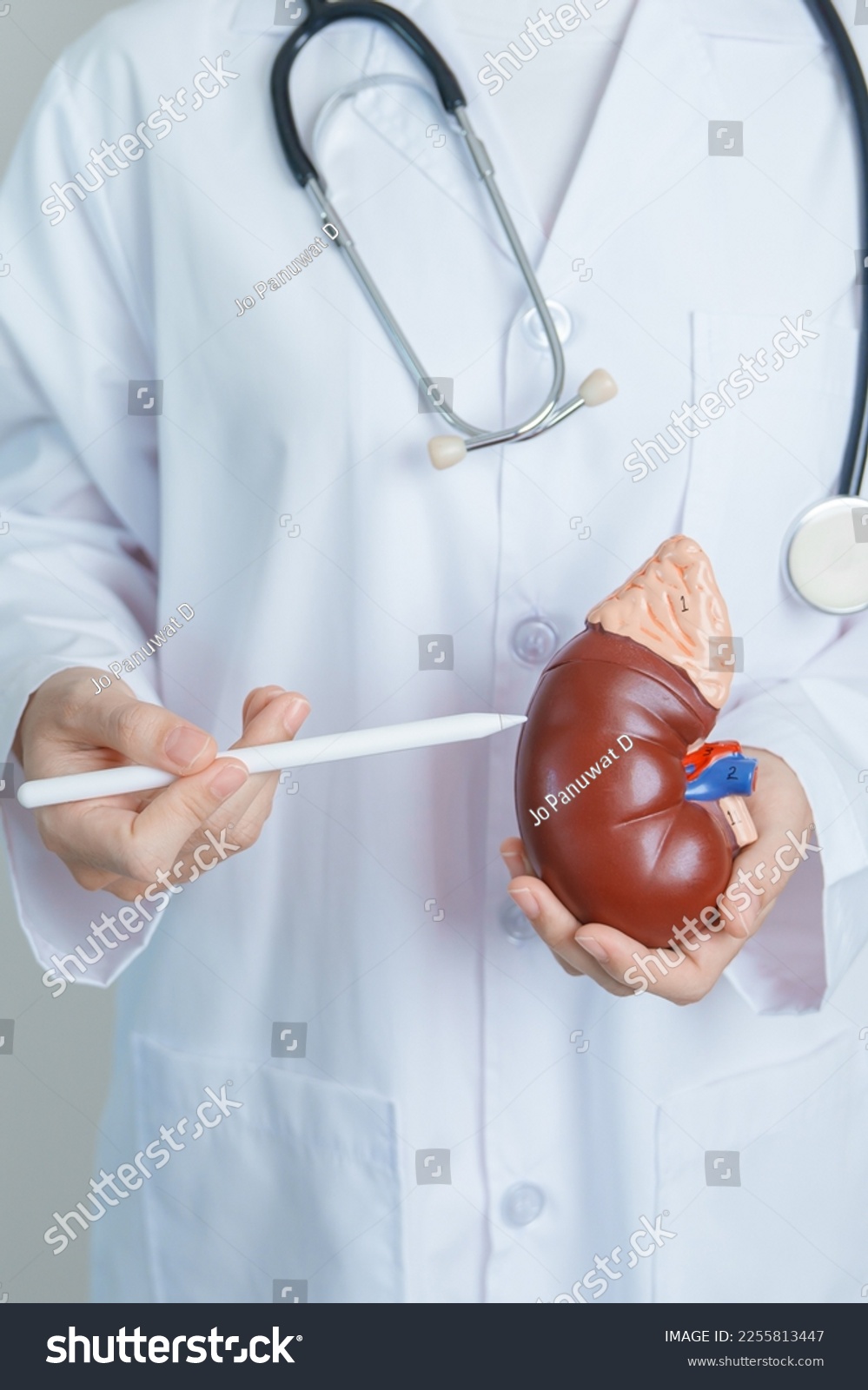 Doctor holding Anatomical kidney Adrenal gland model. disease of Urinary system and Stones  Cancer  world kidney day  Chronic kidney  Urology  Nephritis  Renal and Transplant concept