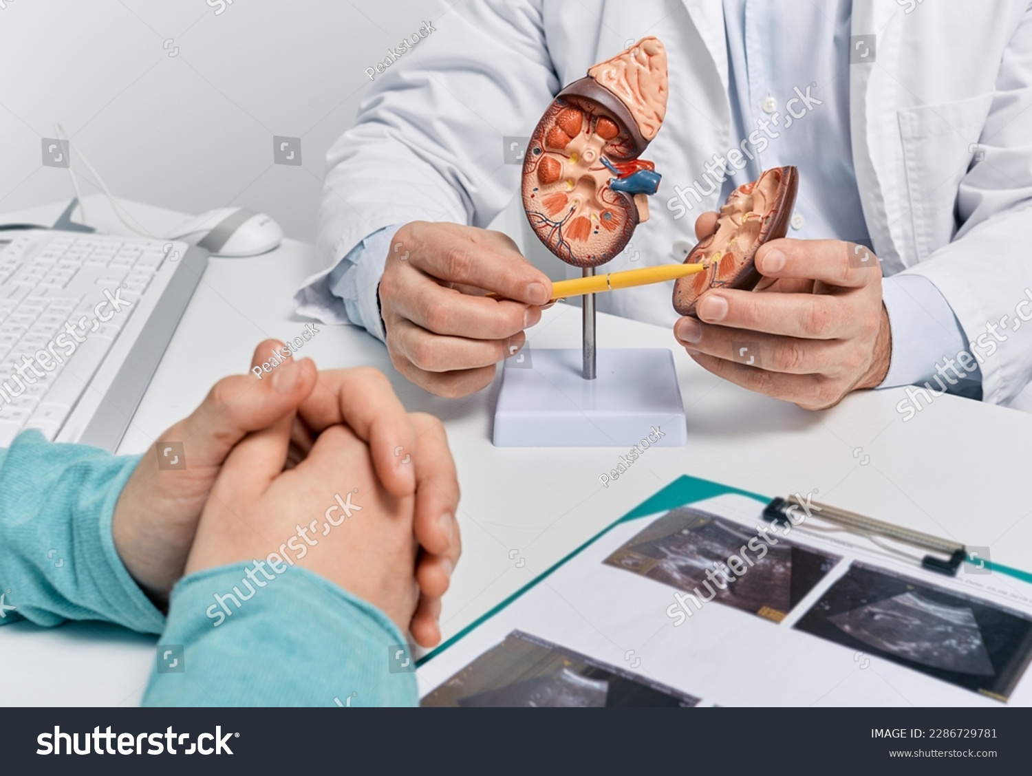 Urology and treatment of kidney disease. Doctor analyzing of patient kidney health using kidney ultrasound and anatomical model