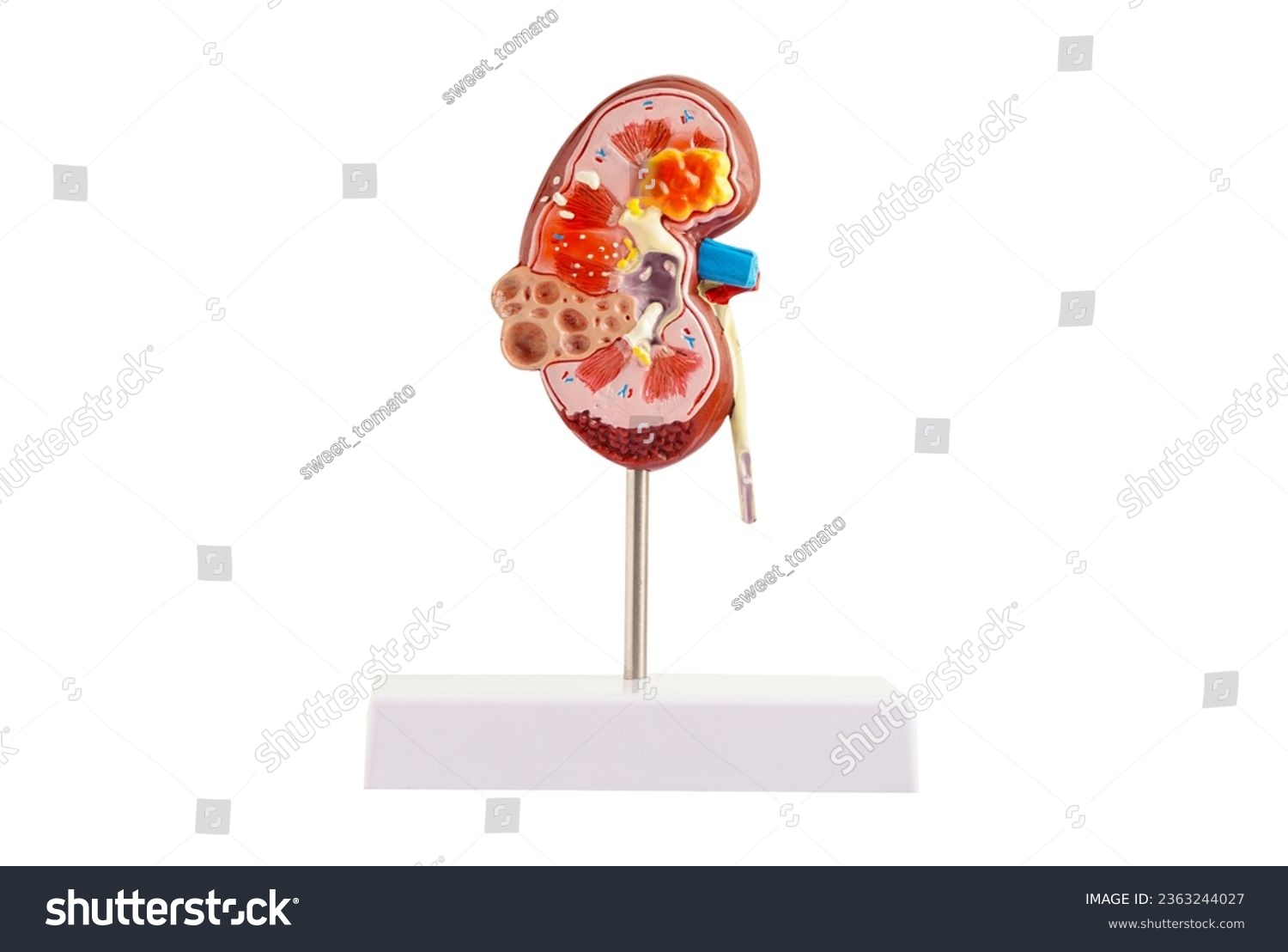 Kidney model isolated on white background with clipping path. Chronic kidney disease  treatment urinary system  urology  Estimated glomerular filtration rate eGFR.