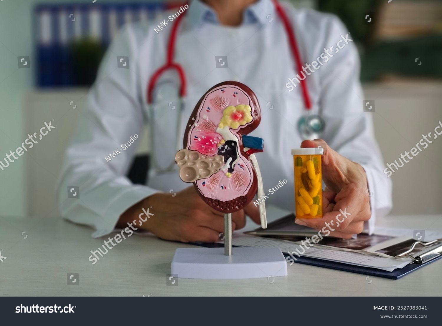 Nephrologist doctor holds in hands an anatomical model of human kidney with pills in clinic. Kidney treatment in clinic
