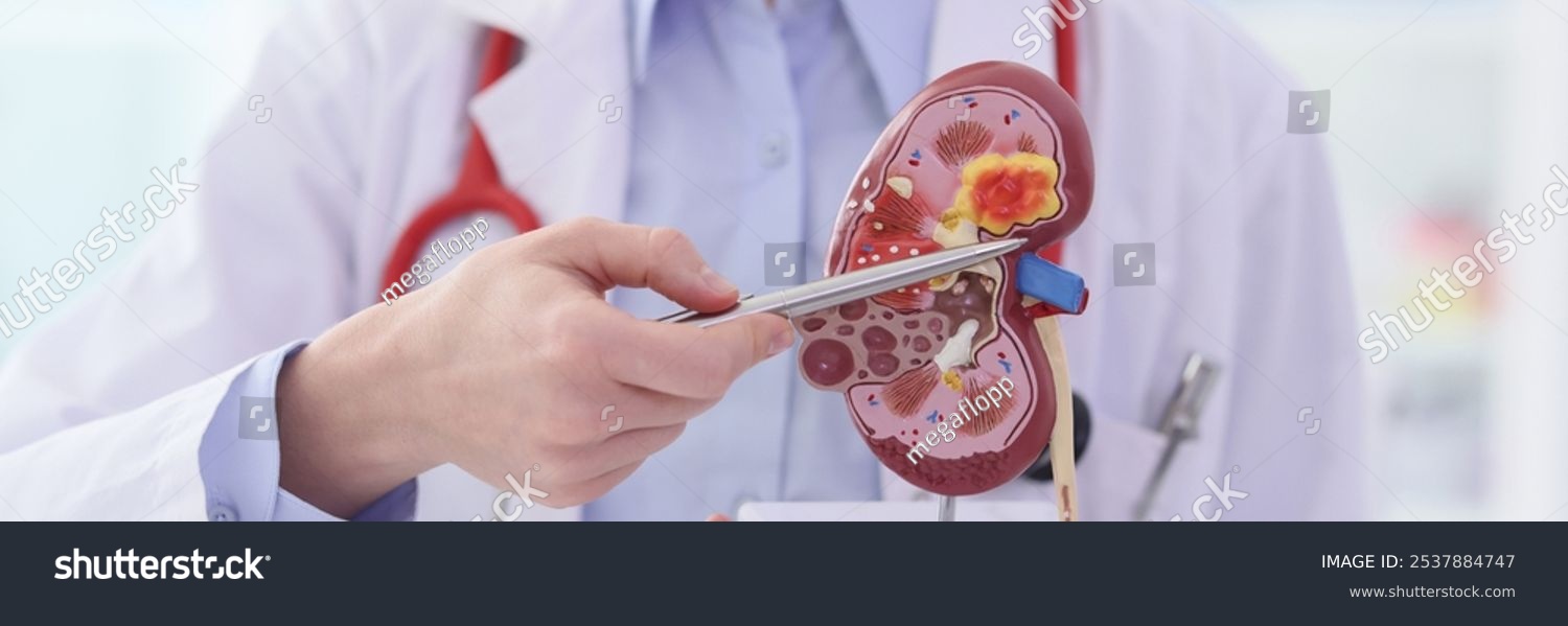Doctor in work uniform points pen to inflammation of kidney artificial model. Specialist demonstrates structure and diseases of human in clinic office