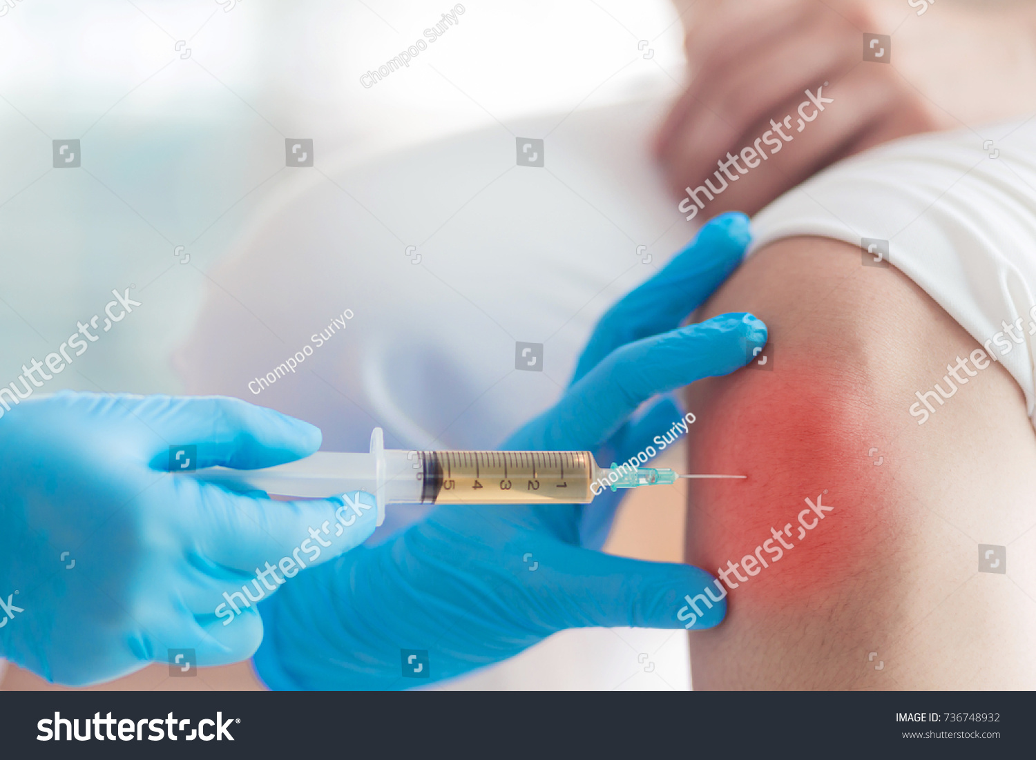 Knee joint aspiration Hand in blues glove take a joint knee fluid sample in the hospital.