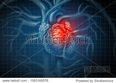 heart attack pain as a human cardiovascular organ