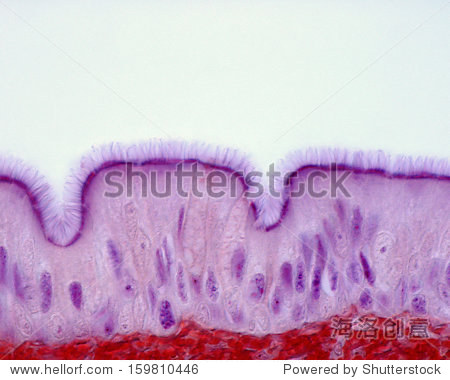 ciliated pseudostratified columnar epithelium of the trachea