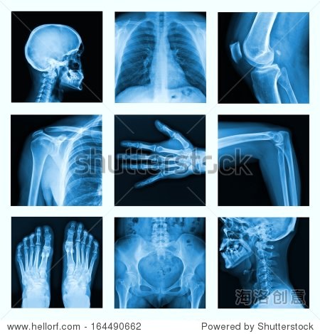 collage of many x-rays. very good quality / many others x-ray im