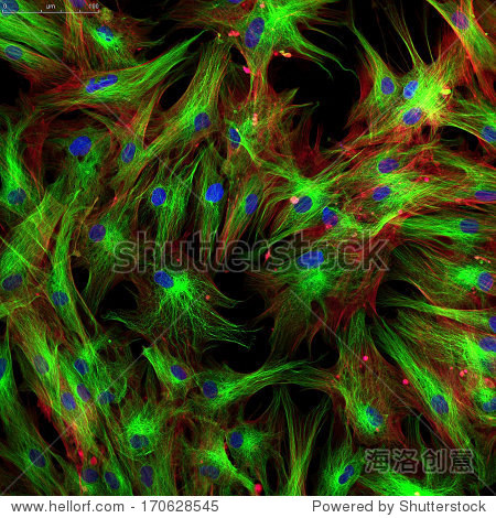 fibroblasts (skin cells) labeled with fluorescence dyes.