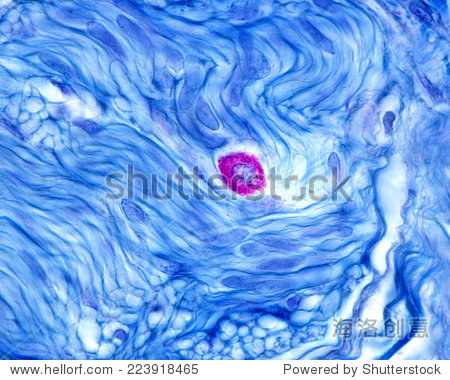 mast cell or mastocyte with its cytoplasm filled with large