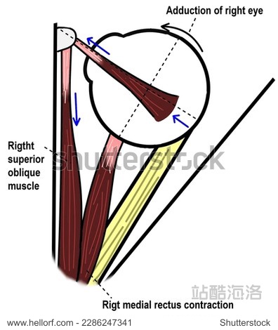 眼睛 斜 上级 功能 肌肉 控制 移动