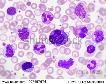 kind of white blood cell in peripheral blood smear