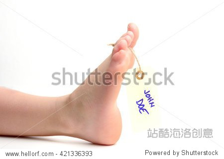 foot with john doe mark on it - 图片素材
