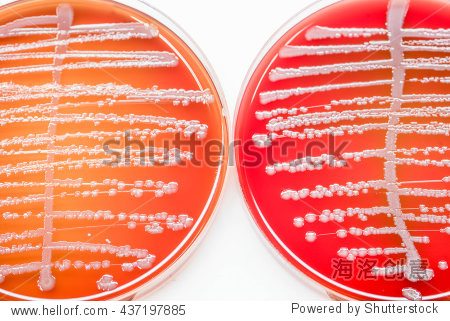 staphylococcus aureus/ staphylococcus spp. bacterial culture gro