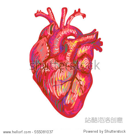 medical anatomical art. coronal artery thrombosis.