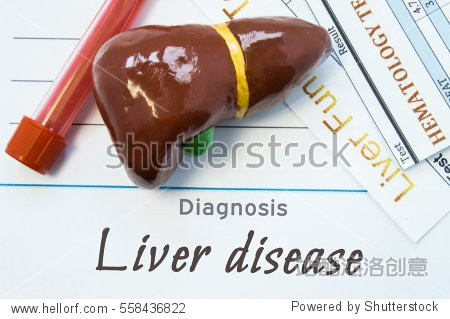 sheet of paper or book with inscription liver