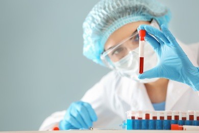 woman holding test tube with blood sample in laboratory
