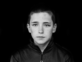 portrait of middle school age boy with bruises all over his face. black eye and bruised cheek and forehead. 