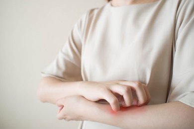 young woman scratching arm from having itching. cause of itchy skin include insect bites, eczema, dermatitis, food/drugs allergies or dry skin. health care concept. close up.