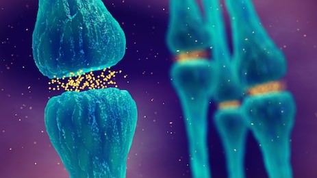 synaptic transmission, brain synapses pathology and neurological disease, 3d illustration