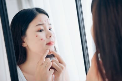 young asian woman squeeze acne problem face looking at mirror her without skincare. 