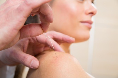 doctor hands acupuncture needle pricking on woman patient closeup