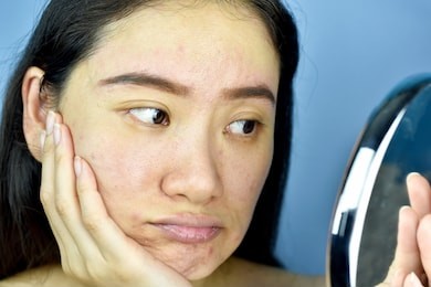 asian woman looking at herself in the mirror, female feeling annoy about her reflection appearance show the aging facial skin signs, wrinkles, dark spot, pimple, acne scar, large pores, dull skin.
