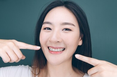 asian woman wareing orthodontic retainers.teeth retaining tools after braces . pointing her mouth.