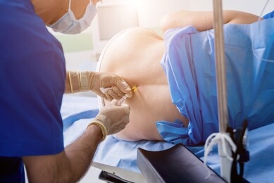 epidural anesthesia injections. prepare for surgery. medical background