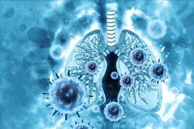 virus and bacteria infected the human lungs.lung disease.3d illustration
