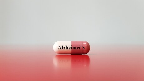 capsule of medicine for treatment alzheimer's disease. alzheimer cause brain cells degeneration that lead to memory loss (dementia disorder). skills. neurology and medical technology concept.