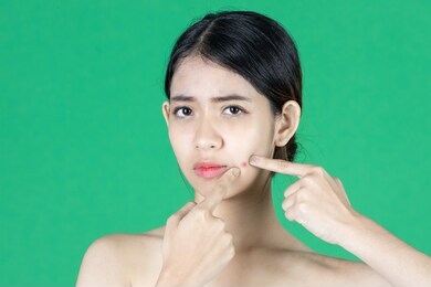 worried anxiety young asian woman touching her skin face with finger and looking acne problem over green isolated background. beauty skin care concept.