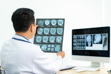 asian man doctor holding and looking to examining x-ray of the patient skull and brain in a medical clinic at hospital. 