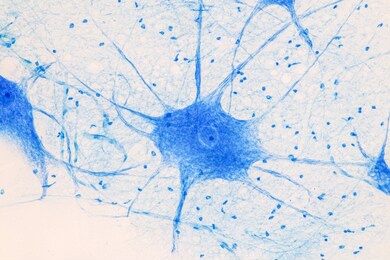 motor neuron under the microscope in lab.
