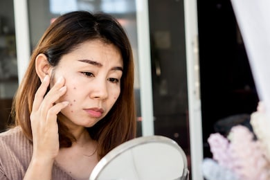asian woman checking her face skin problem with acne scar, dark spot on mirror