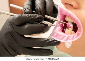 the dentist examines the depth of the patient's gums
