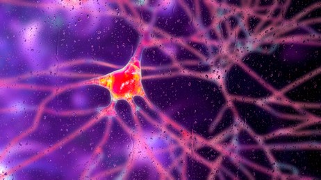 neurons in dementia, conceptual 3d illustration. destruction of neurons and neuronal networks