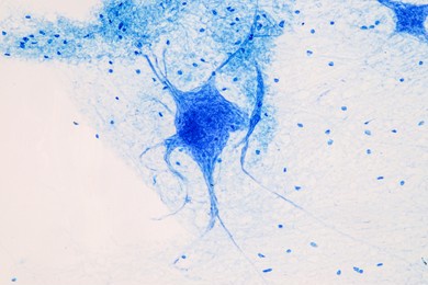 education spinal cord, nerve, cerebellum, cortex and motor neuron human under the microscope in lab.
