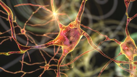 neurons of dorsal striatum, 3d illustration. dorsal striatum is a nucleus in the basal ganglia
