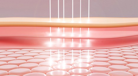 laser or serum vitamin through the skin layer for repair wrinkles and reduce up saggy skin of the skin cell. skin repair concept.